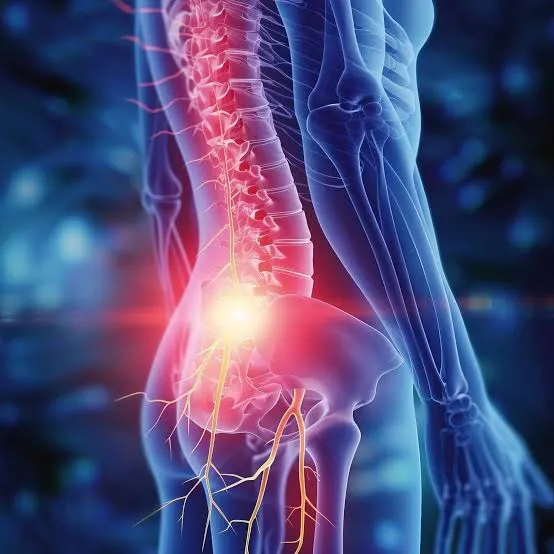 Illustration of the lower spine and nerves — the overlap where people confuse nerve pain and joint pain