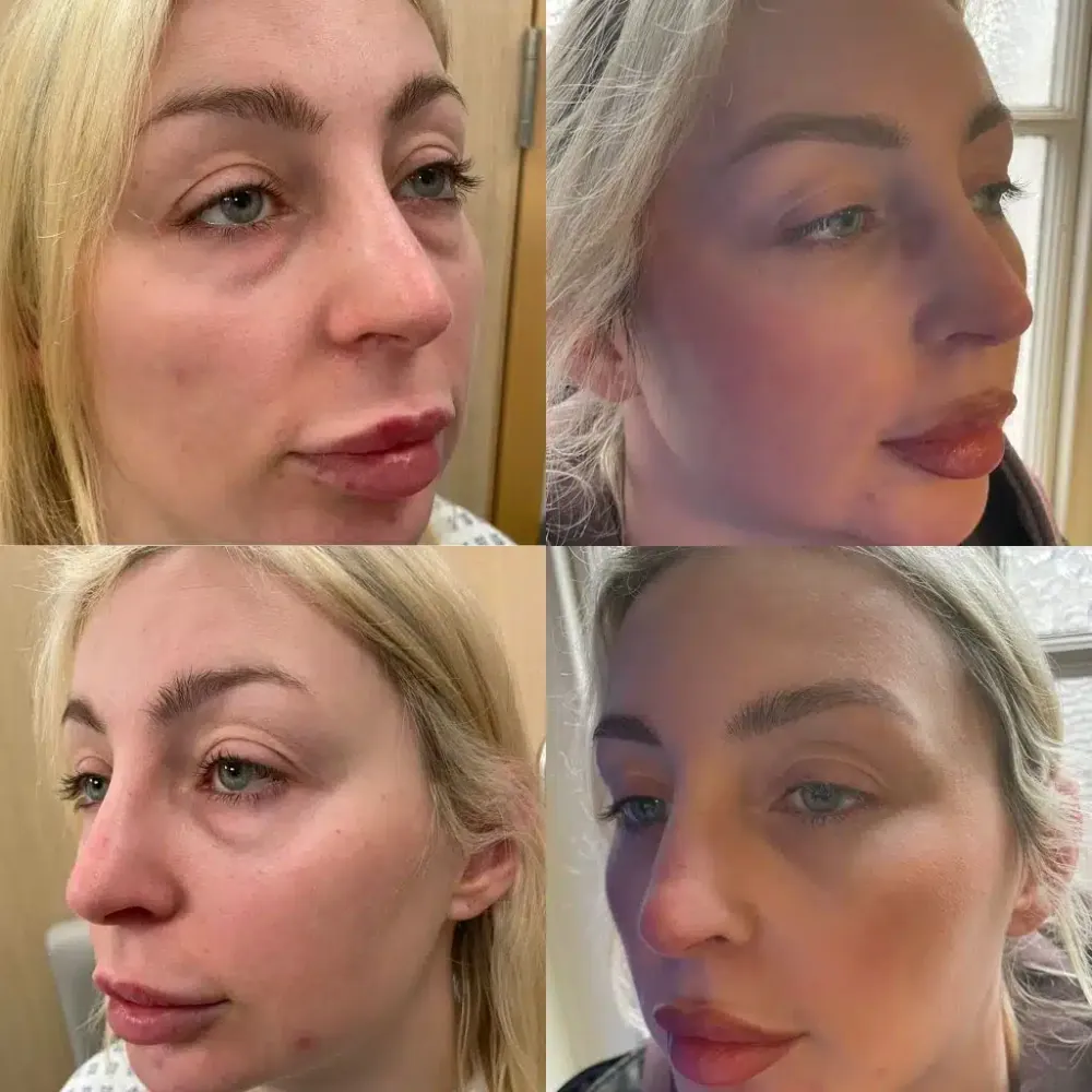 Before and after photo of a customer’s face, published by the manufacturer