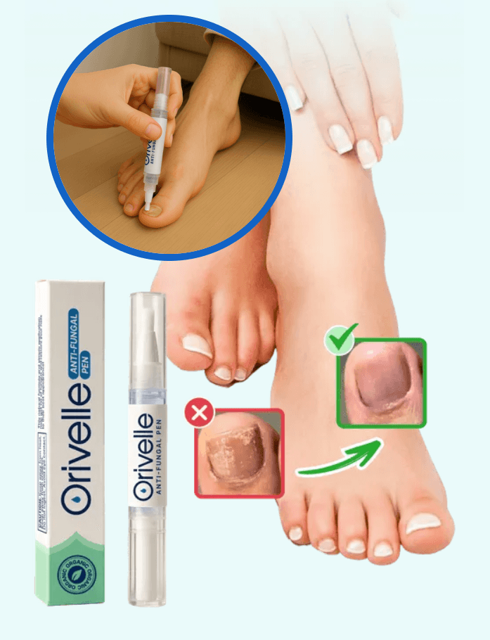 Orivelle Fungus Pen in action — precision pen applicator targeting nail fungus with tea tree oil formula