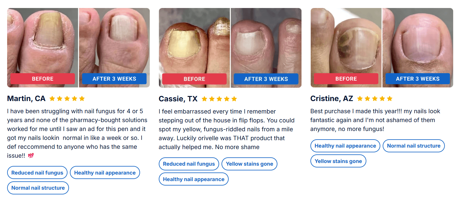 Orivelle Fungus Pen customer reviews — 4.9 out of 5 average rating from thousands of verified buyers