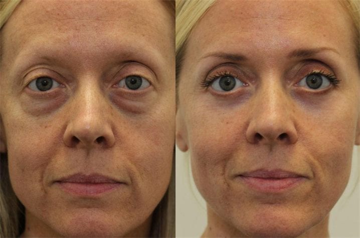 Rebecca T. — before and after